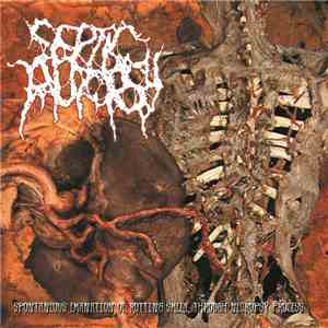 Septic Autopsy - Spontaneous Emanation Of Rotting Smell Through Necropsy Process download mp3