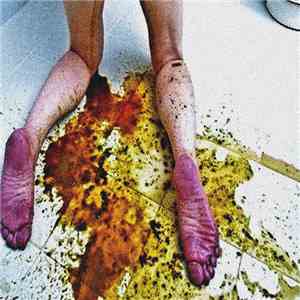 Epiploenterocele Pusliquid Wormchunk - The Scat Section download mp3