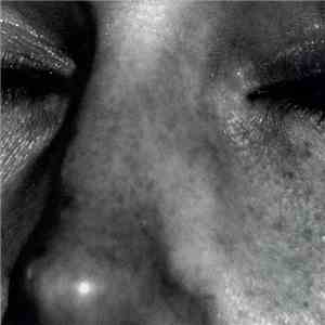 Christian Rottler - Feuer download mp3